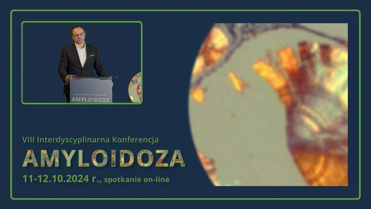 Nowe projekty Polskiego Konsorcjum Szpiczakowego
