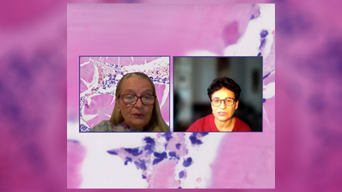 Jak wykonać bezpośrednie typowanie amyloidu? Immunohistochemia