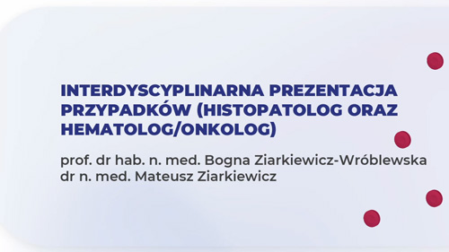 Transformacja CLL / SLL do cHL - przypadek kliniczny