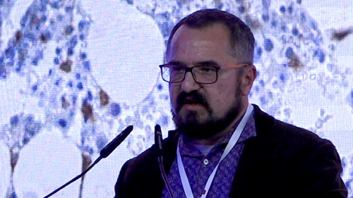 Mastocytoza | Cytometria przepływowa