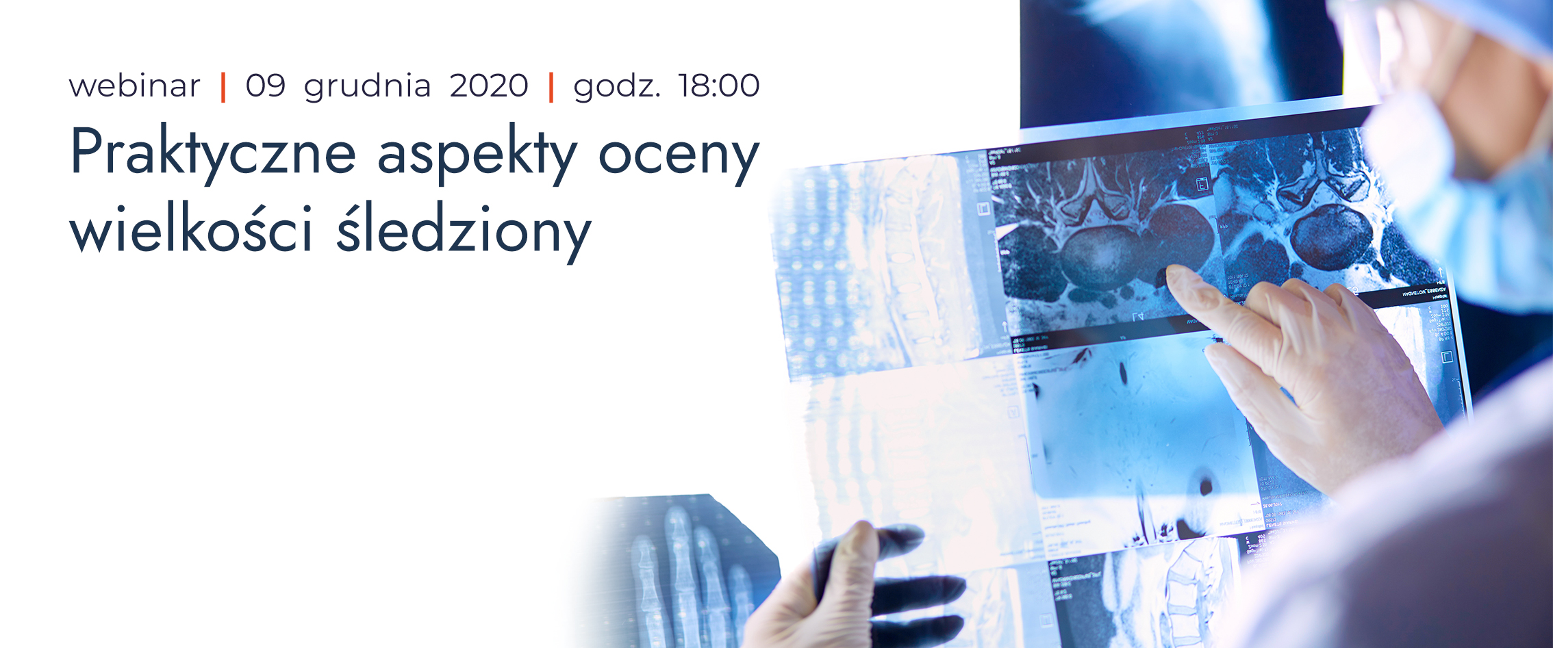 Praktyczne aspekty oceny wielkości śledziony